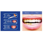 Dazzling White Instant Teeth Whitening Pen